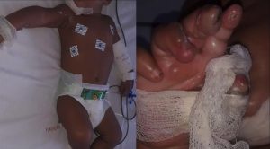 nangtime.com - Bayi 6 Bulan Terkena Renjatan Elektrik Akibat Tergigit Wayar Pengecas Handphone