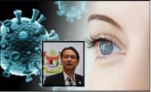 nangtime.com - COVID-19 Boleh Berjangkit Masuk Melalui Mata