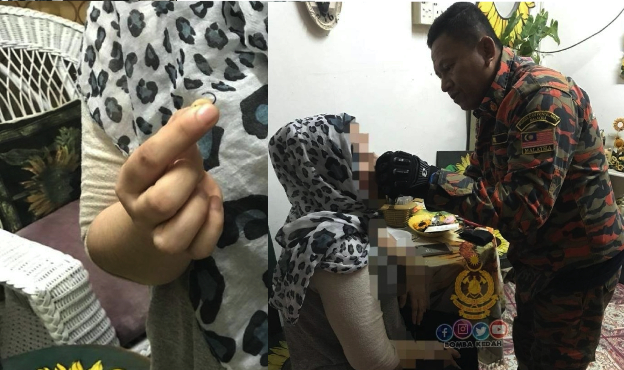 nangtime.com - Subang Tersangkut Di Hidung Dan Tak Dapat Dicabut, Wanita Terpaksa Minta Bantuan Bomba