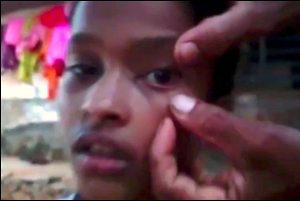 nangtime.com - Gatal Di Bahagian Mata, Tak Sangka Berpuluh Semut Ditemui Bawah Kelopak Mata Budak Perempuan