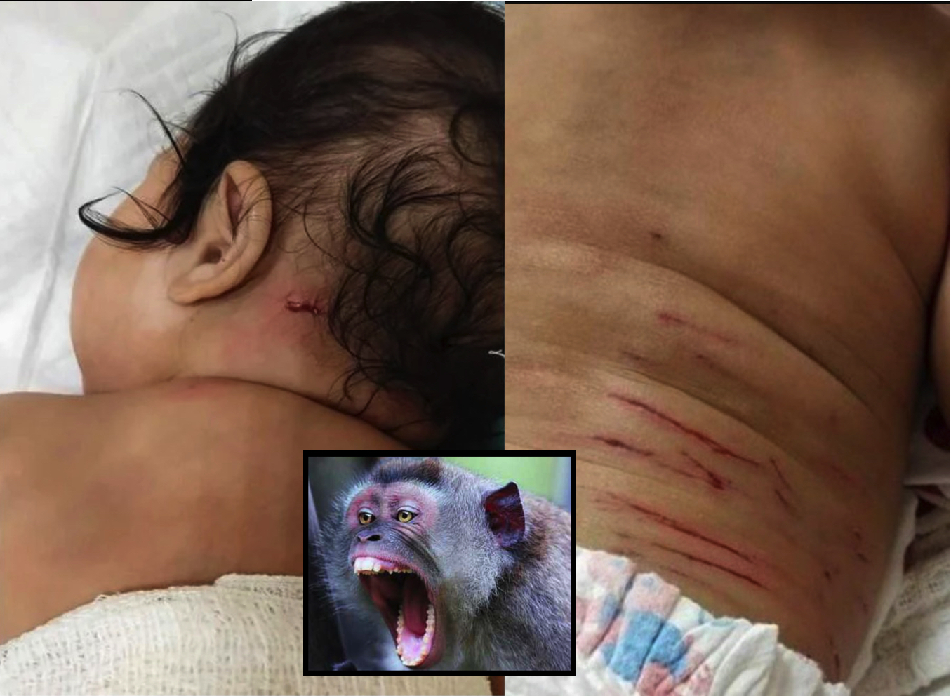 nangtime.com - Bayi Perempuan Nyaris Dilarikan Monyet Liar Dari Rumah