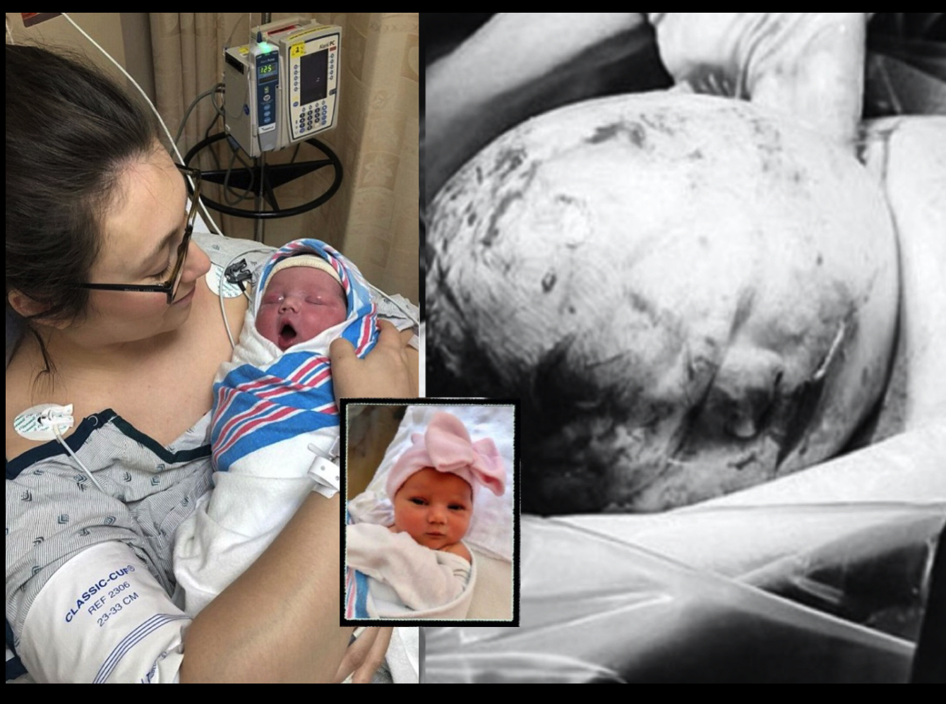 nangtime.com - Bapa Panik Bayi Lahir Dengan Benda Aneh Di Kepala, Tambah Bingung Bila Nurse Suruh Ambilkan Gambar