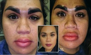 Kening Berubah Jadi Shin Chan, Wanita Terpaksa Ulang Alik Lebih 4,000km Untuk Mendapatkan Kening Asalnya - nangtime.com