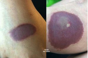 Buat Bodoh 10 Saat, Pelajar Perempuan Kemungkinan Terpaksa Tanggung Derita 2 Tahun - nangtime.com